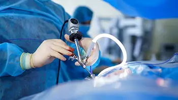 laparoscopy